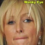 Paris-to-Fix-That-Wonky-Eye-and-Lazy-Lid-3